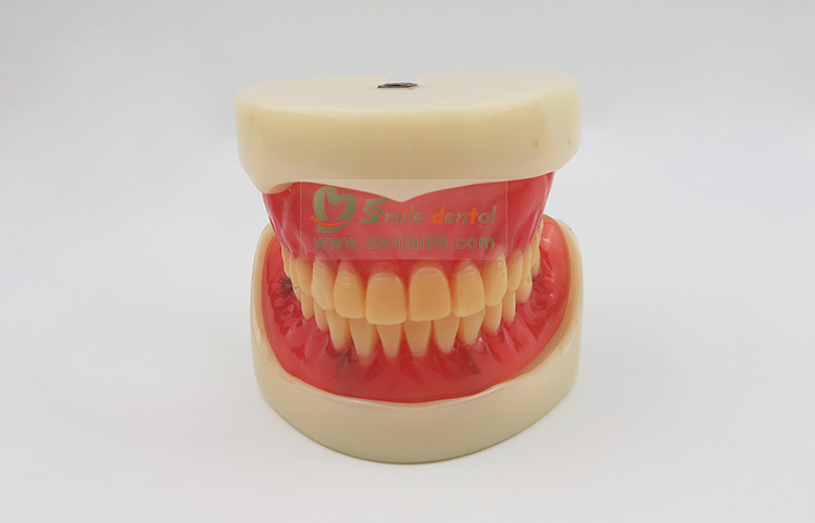 Full Denture Implant Mode